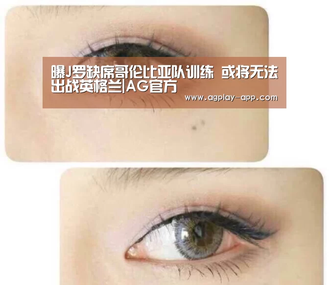 曝J罗缺席哥伦比亚队训练 或将无法出战英格兰|AG官方(图4) AG电竞